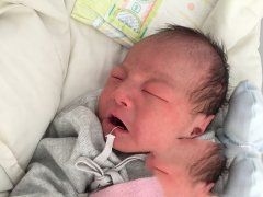 �����Ⱦɫ���쳣�Թܵ���